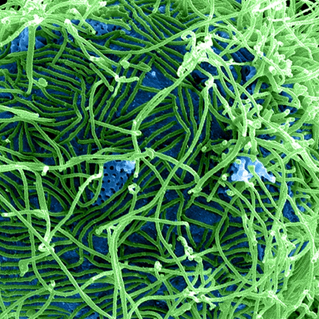 Colorized scanning electron micrograph of filamentous Ebola virus particles