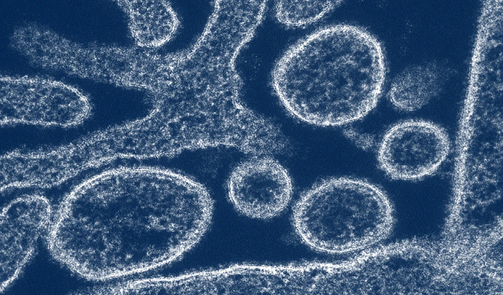 Colourised transmission electron micrograph of Nipah Virus particles