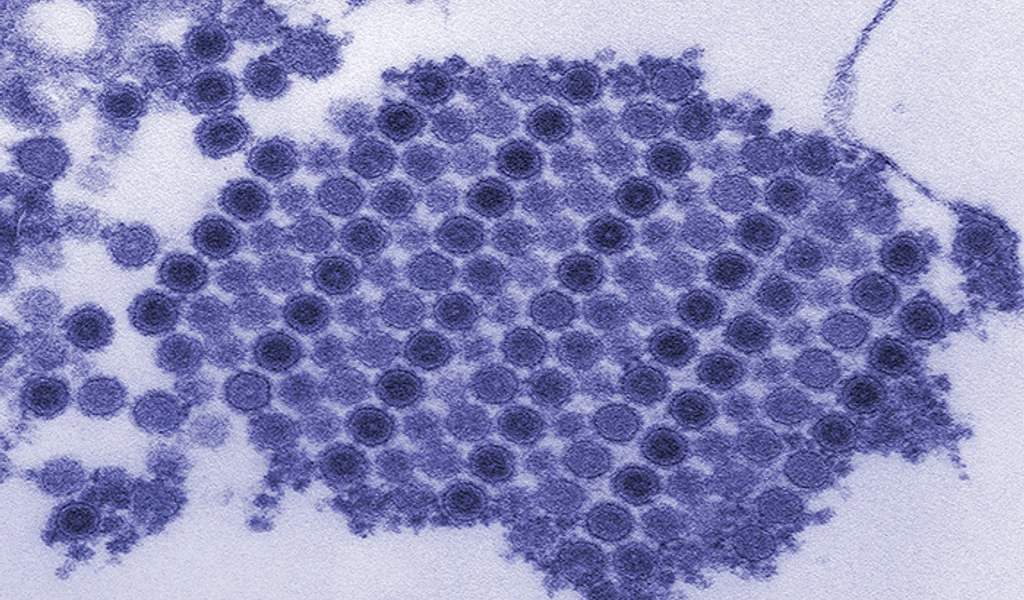 chikungunya virus