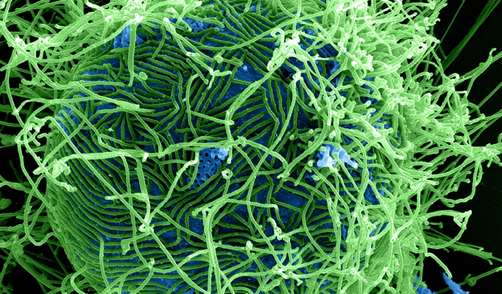 Colorized scanning electron micrograph of filamentous Ebola virus particles