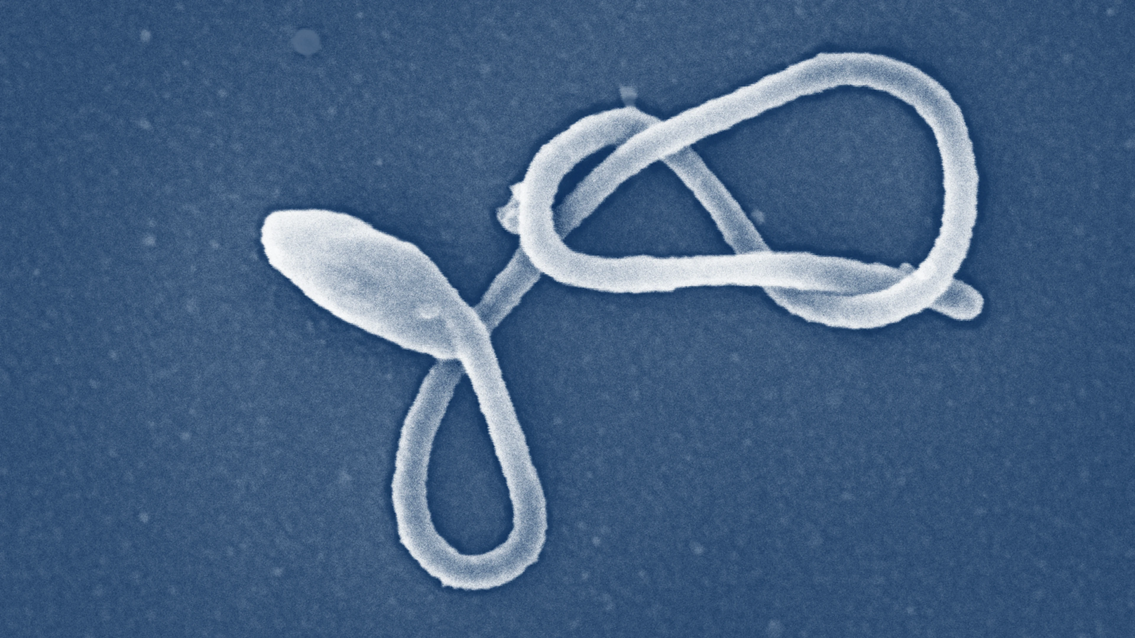 A close up image of an Ebola virus particle