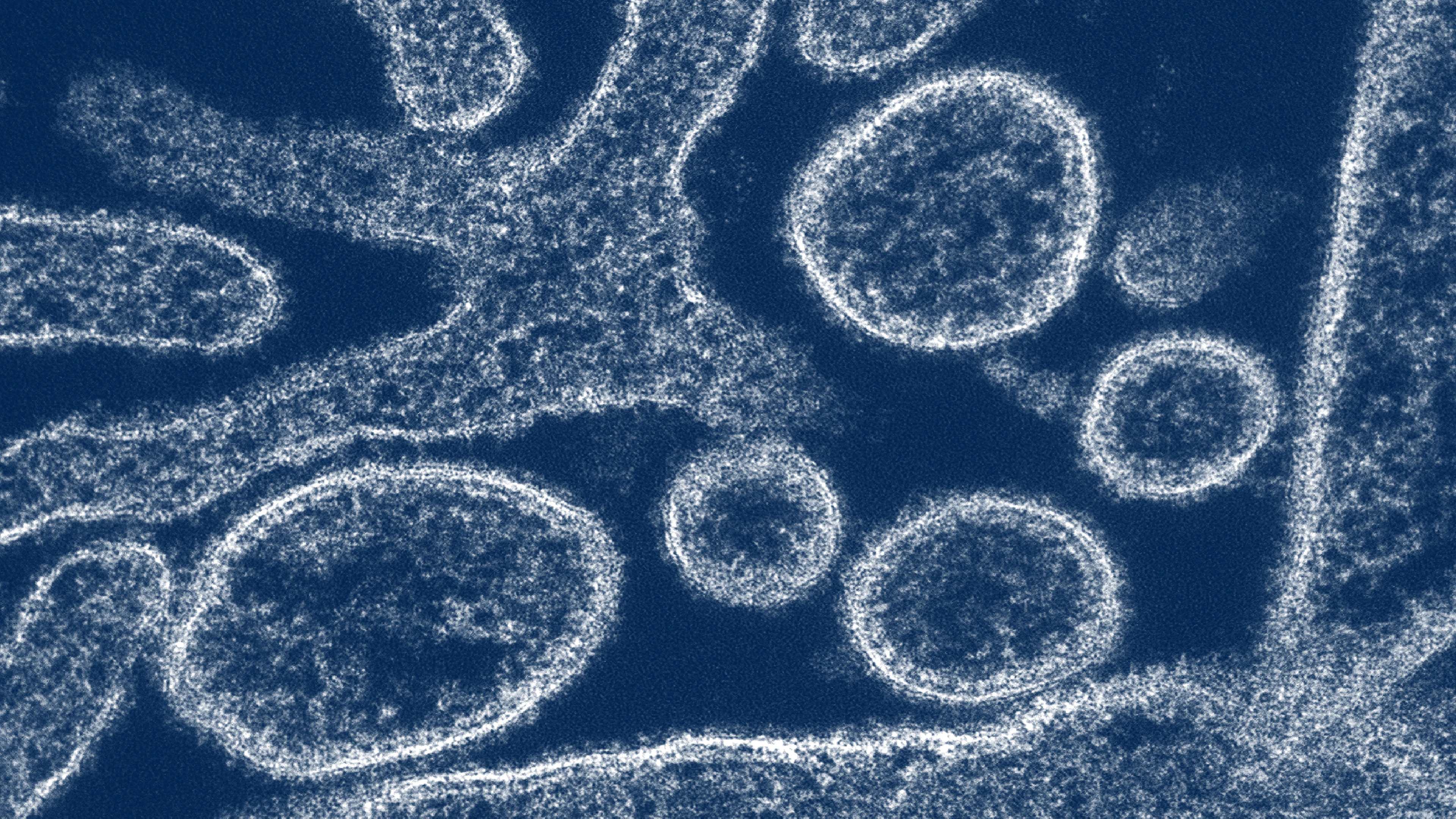 Colourised transmission electron micrograph of Nipah Virus particles