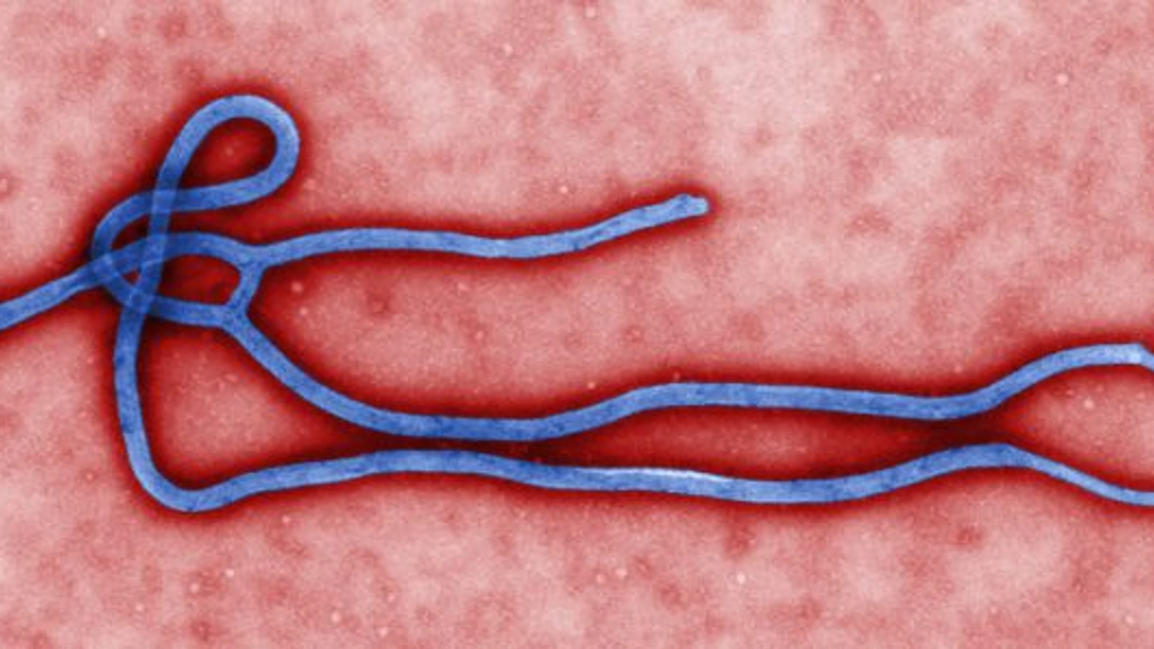 about-ebola-medium