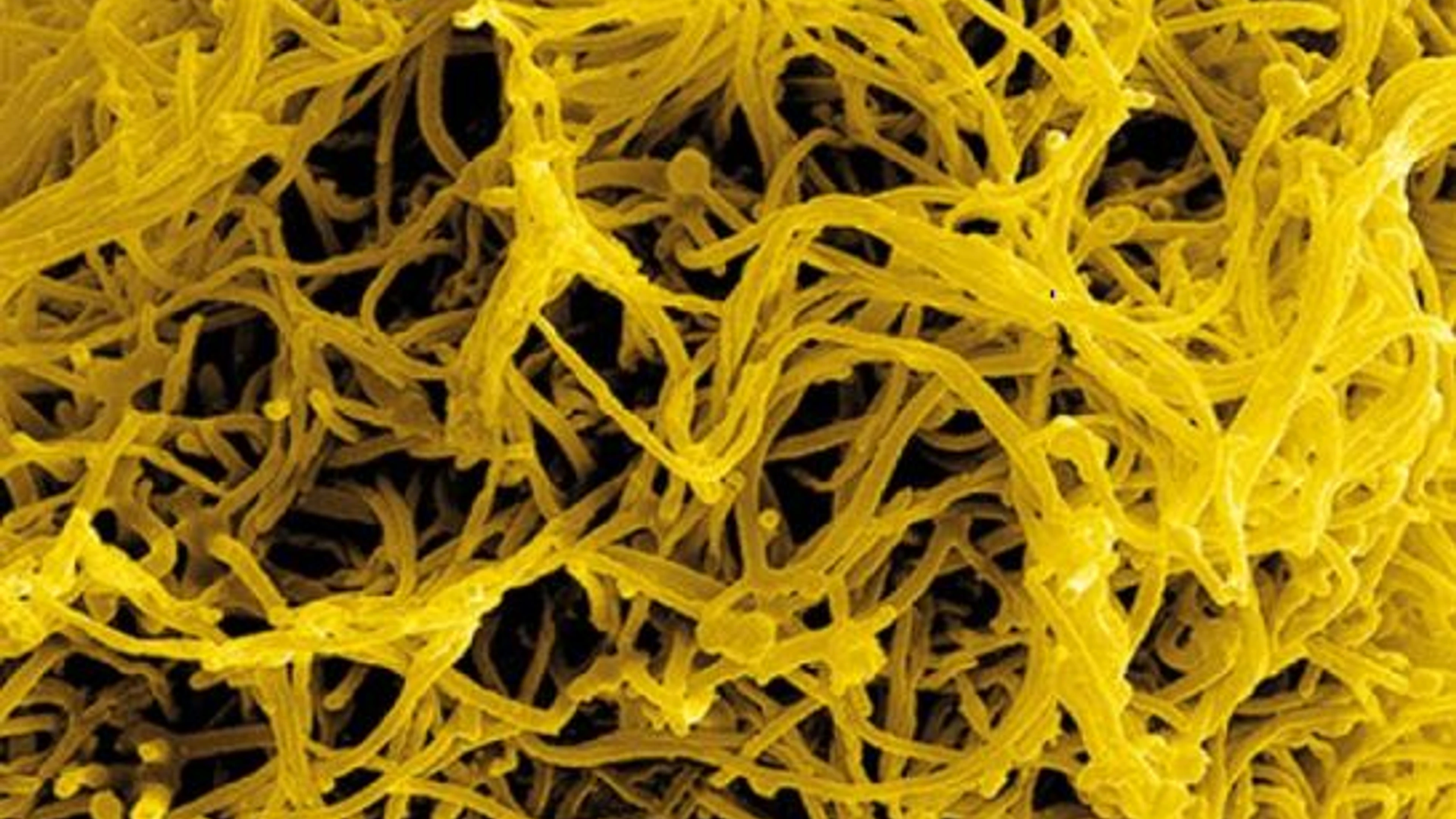 colourised scanning electron micrograph of filamentous ebola virus particles