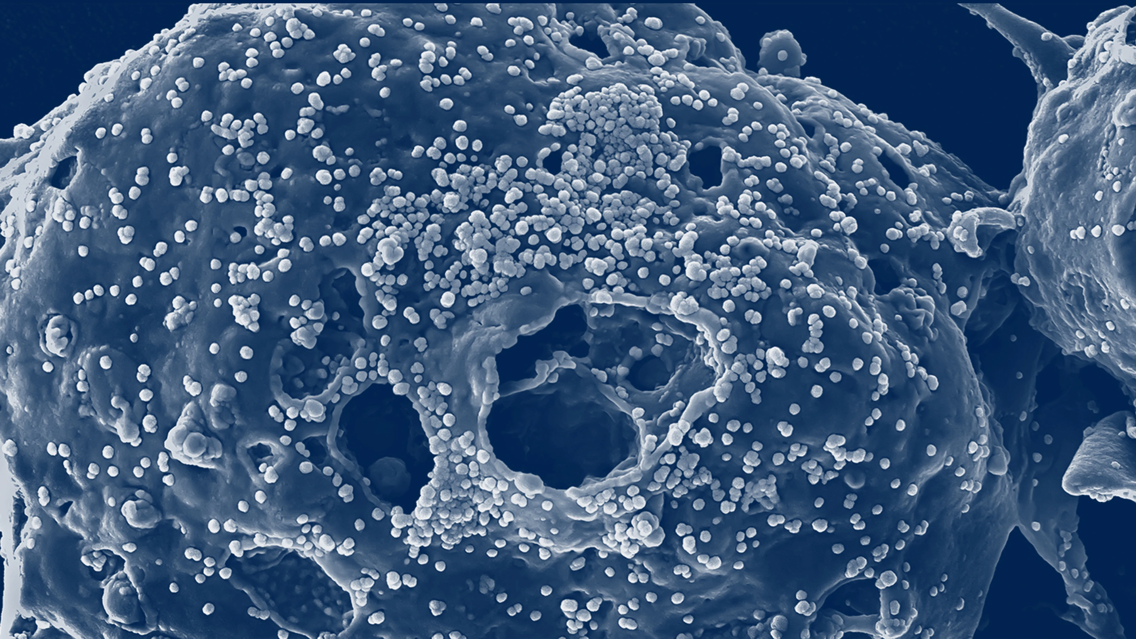 closeup of mers-cov particles with blue filter