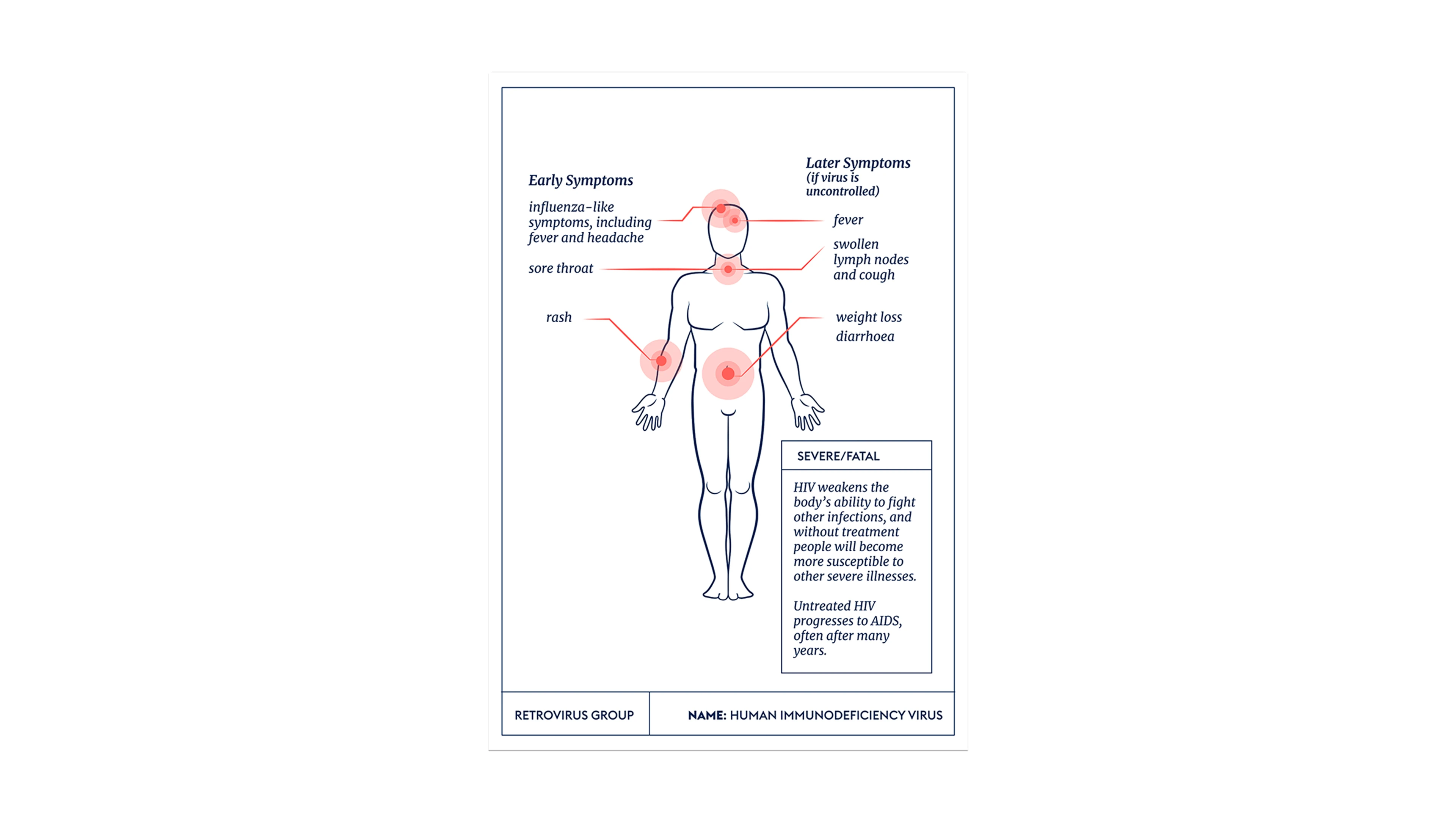 Graphic illustration showing HIV symptoms on human outline
