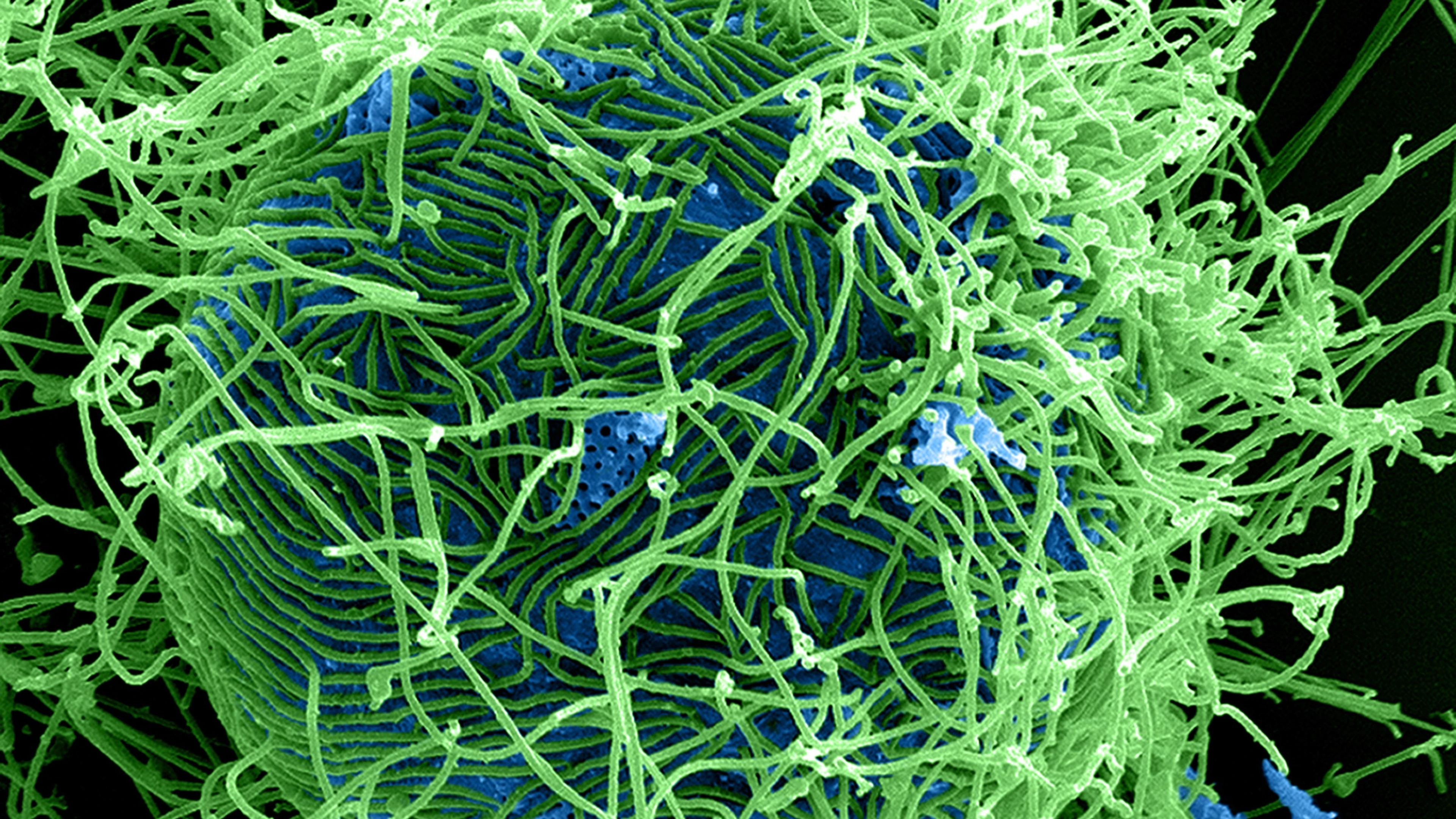 Colorized scanning electron micrograph of filamentous Ebola virus particles